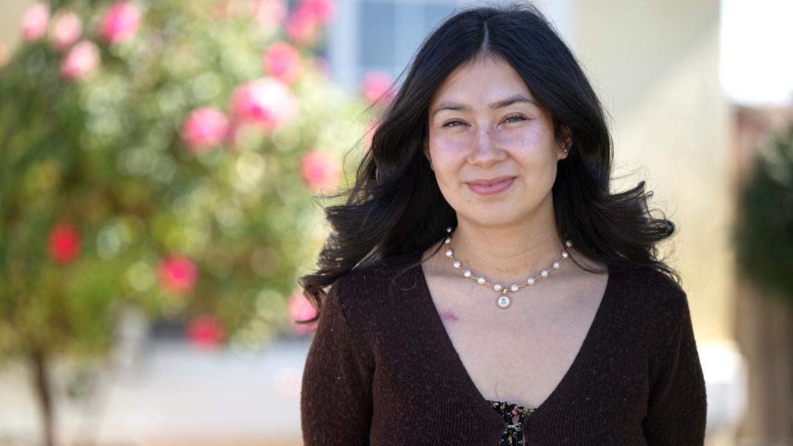 Modesto hospital uses miniature heart pump to save mother’s life after cardiac arrest