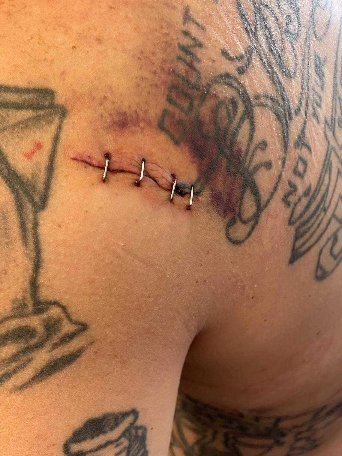 Casey Rich was stabbed 10 times in a Ceres McDonald’s by a Door Dash driver.