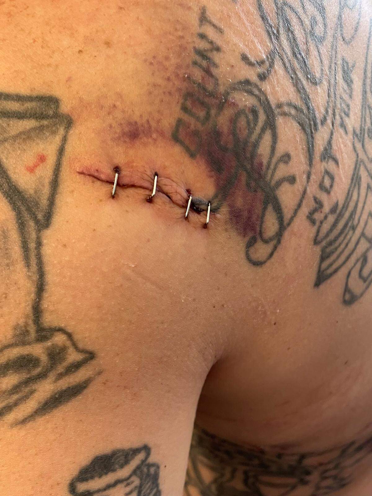Casey Rich was stabbed 10 times in a Ceres McDonald’s by a Door Dash driver.