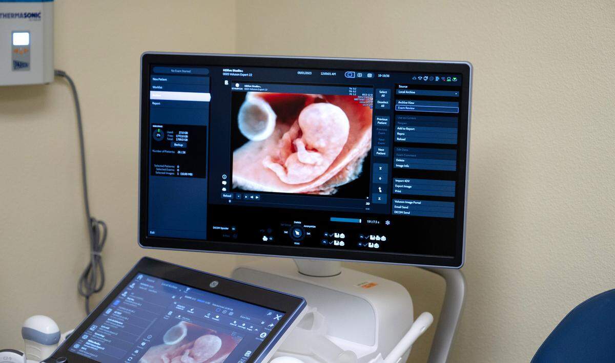 Imaging equipment in the ultrasound exam room at the Maternal Fetal Medicine clinic in Modesto, Monday, April 14, 2025.