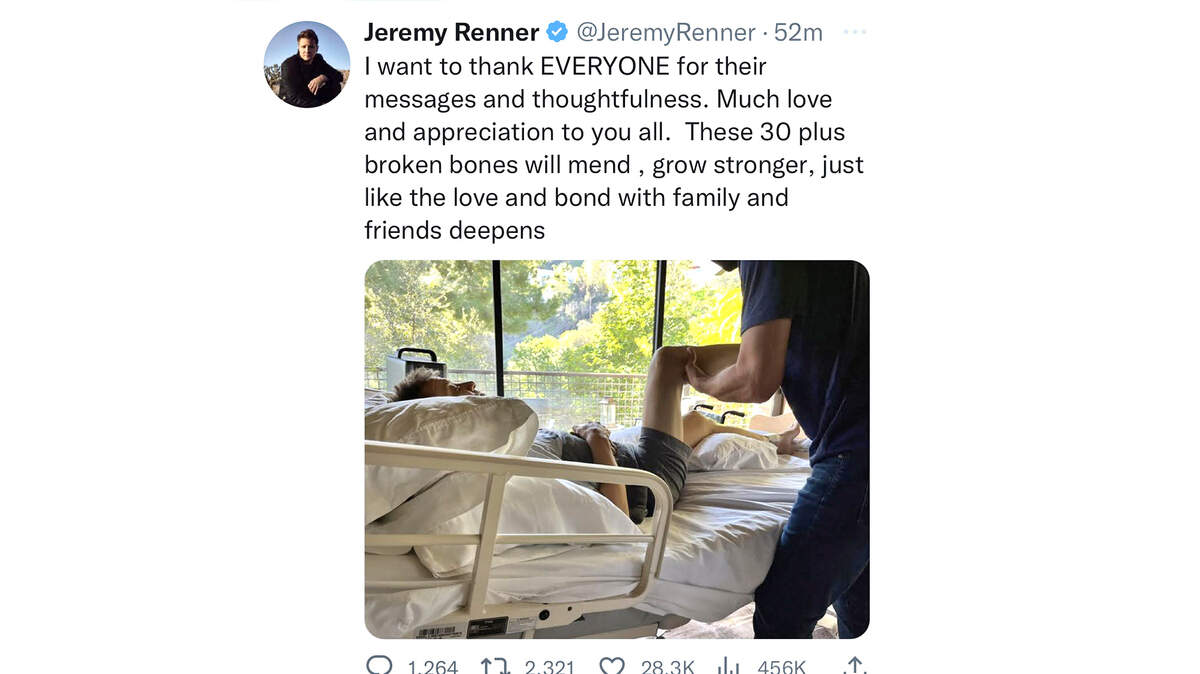 Actor and Modesto native Jeremy Renner says he suffered more than 30 broken bones, in a Twitter post updating his progress after a New Year’s Day snowplow accident that put him in the hospital for two weeks.