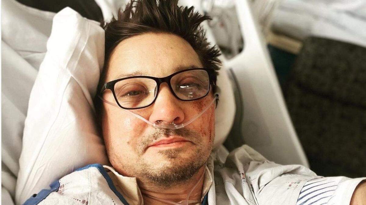 Jeremy Renner posted this photo on his Instagram page in January after the snowplow accident.