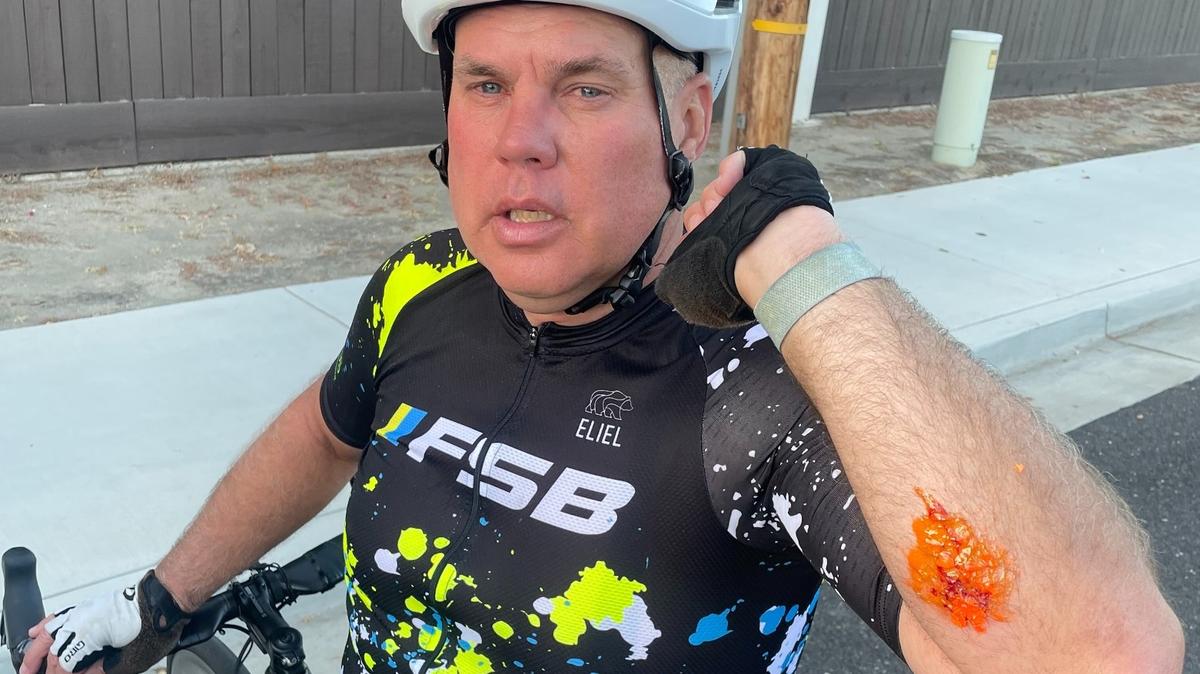 In this photo he shared on Facebook, Mitch Boehs shows where he was struck by a paintball fired at him Wednesday evening when he was biking in Turlock.