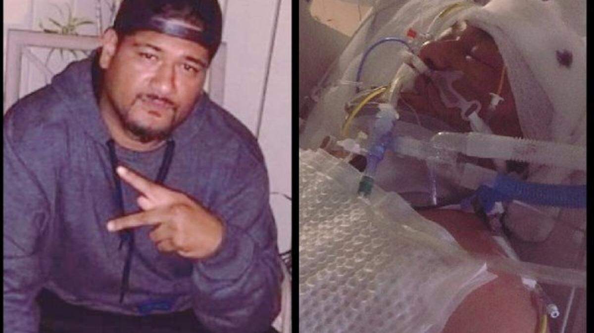 Modesto resident Melea Uili suffered a head injury outside a bowling alley the night of Dec. 15.  His wife says he's been kept in a coma since.