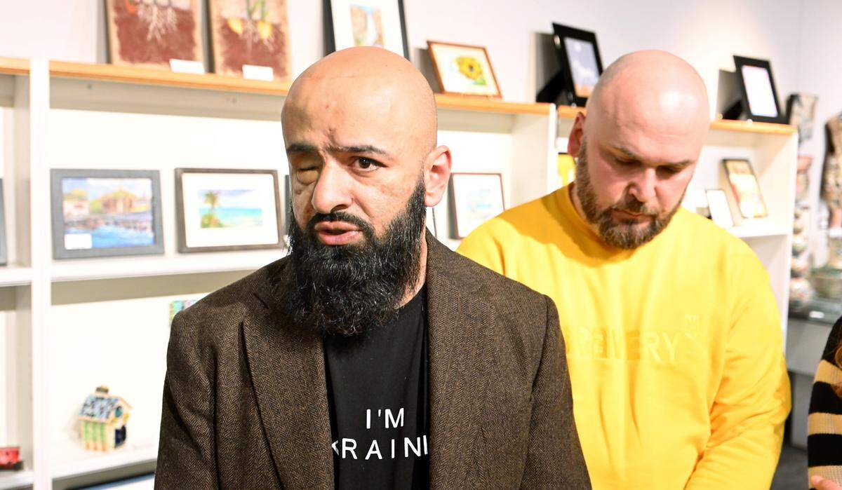 Ukrainian delegate Masi Nayyem was wounded during the war in June 2022, losing his eye. Modesto Sister Cities International hosted a delegation from Ukraine on Thursday of mostly military people and veterans at the Mistlin Gallery in Modesto, Calif., Thursday, Feb. 1, 2024. 