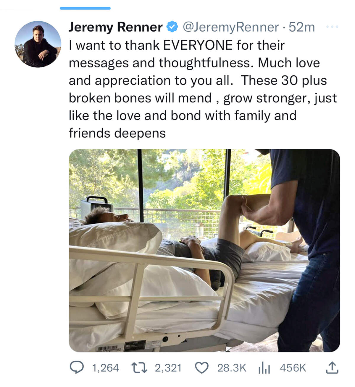 Actor and Modesto native Jeremy Renner says he suffered more than 30 broken bones, in a social media post updating his progress after a New Year’s Day snowplow accident that put him in the hospital for two weeks.