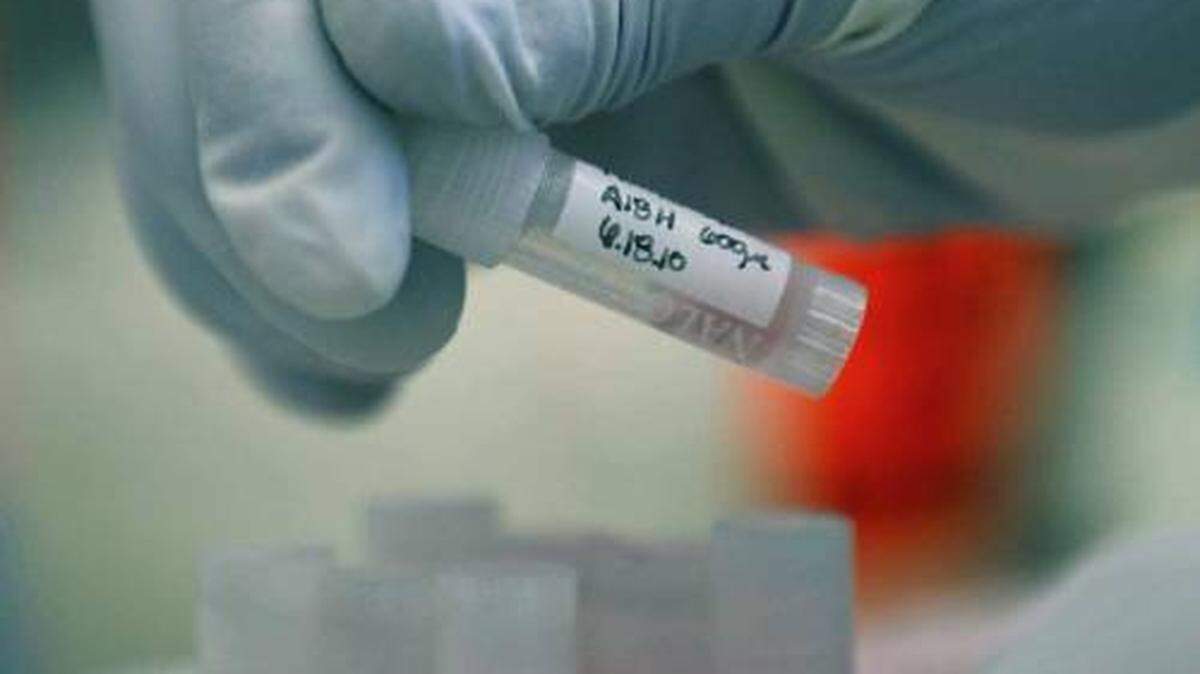 US NEWS SCI-HIV-THERAPY 1 LA