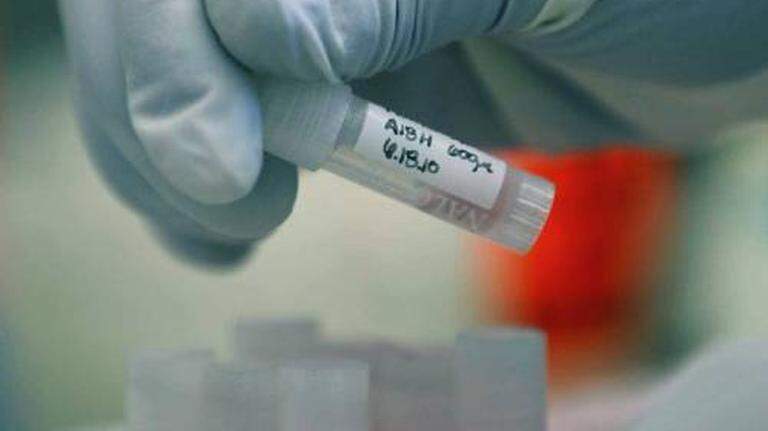 Are health problems of aging HIV patients being underserved in Stanislaus County?