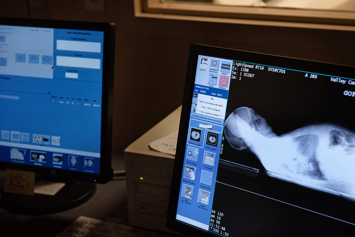Computerized tomography (CT) scan at the Valley Cancer Medical Center in Manteca, Calif., Wednesday, Jan. 23, 2023.