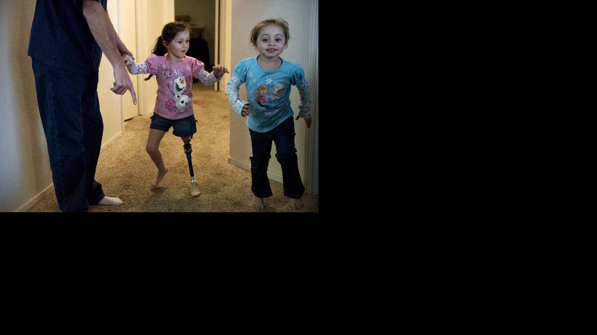 
Amputee Amanda Moeller, 4, plays with her father Toby Moeller and sister Haylee, 3, at their home in Modesto on Friday. Amanda had her leg removed after complications from a heart surgery.
