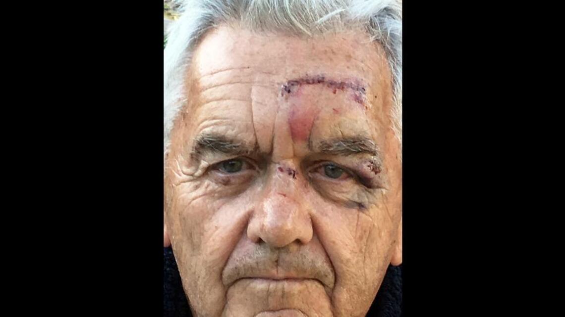 When “I had a lobotomy” says it all