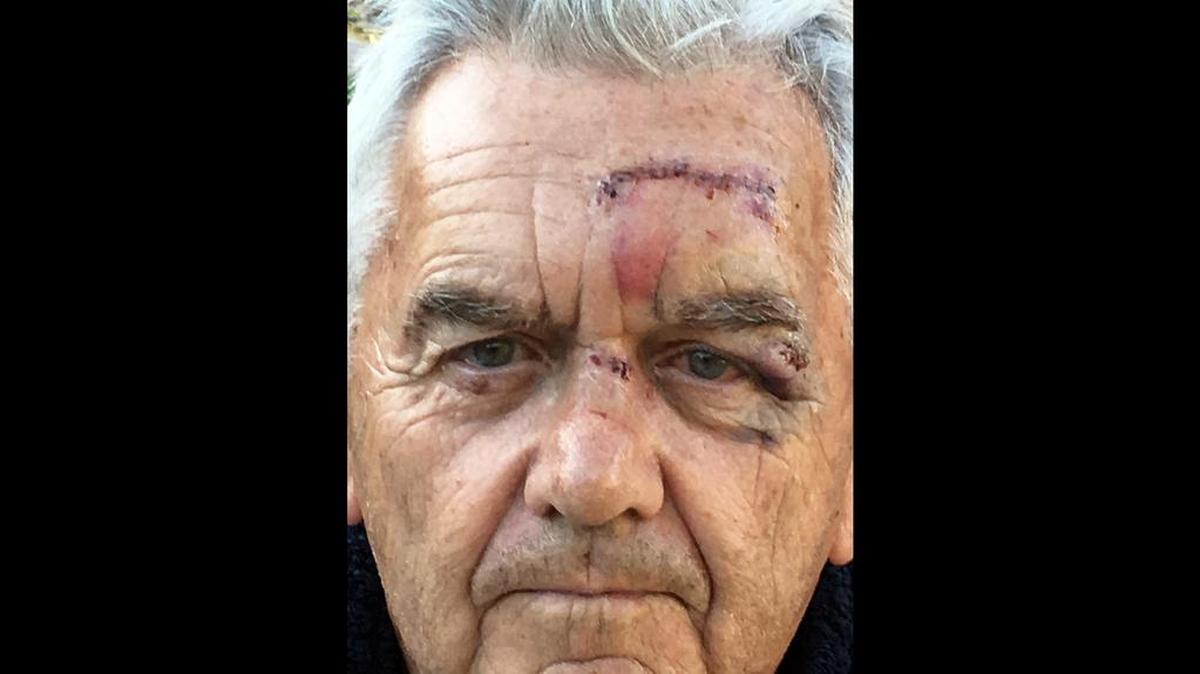 Dick Hagerty, post fall